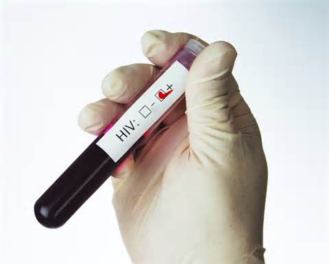 O vírus HIV é transmissor da aids, doença sexual contagiosa.