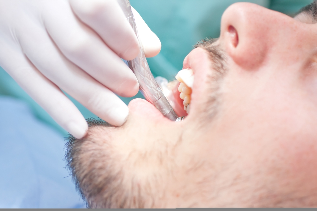 Os tratamentos de canal visam eliminar as dores e impedir a extração do dente.