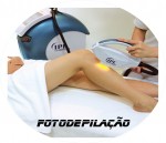 Procedimento reservado para retirada de pelos.